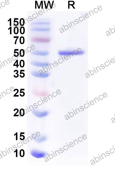 Human VEGF189 Recombinant Protein (C-Fc)