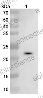Anti-Human VEGFA Recombinant Nanobody (SAA0902)