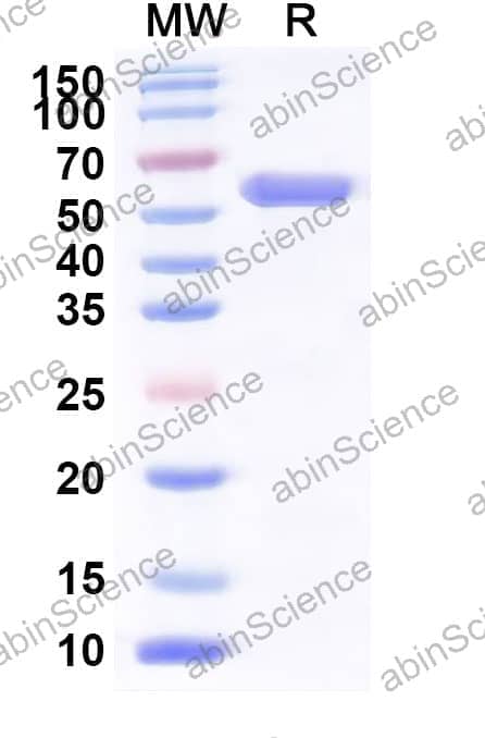 Human Activin RIIA Recombinant Protein (C-Fc)