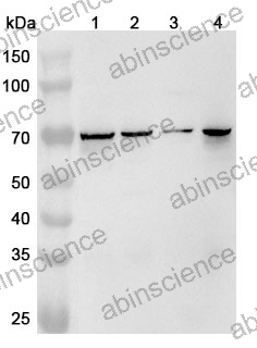 Anti-Human LTK Polyclonal Antibody