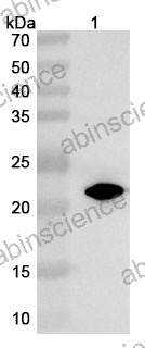 Anti-Human IL11 Reference Antibody (X203, RUO)