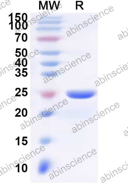 Human HLA-DPA1 Recombinant Protein (N-His)