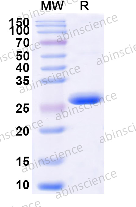 Anti-Human CD19 scFv Recombinant Antibody (FMC63)