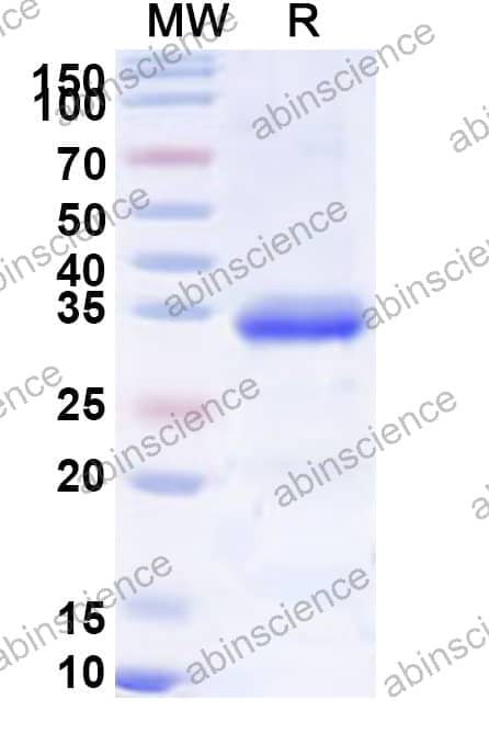 Human IGFBP5 Recombinant Protein (N-His-SUMO&C-Strep)