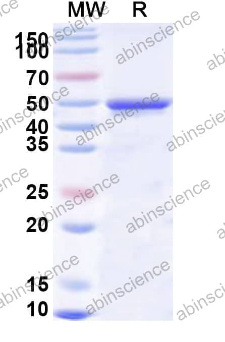 Human KIFC1 Recombinant Protein (N-His)