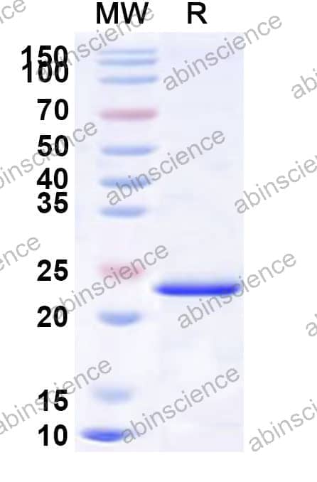 Human ONECUT2 Recombinant Protein (N-His)