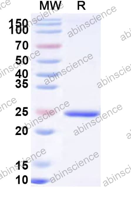 Human KCTD5 Recombinant Protein (N-His)