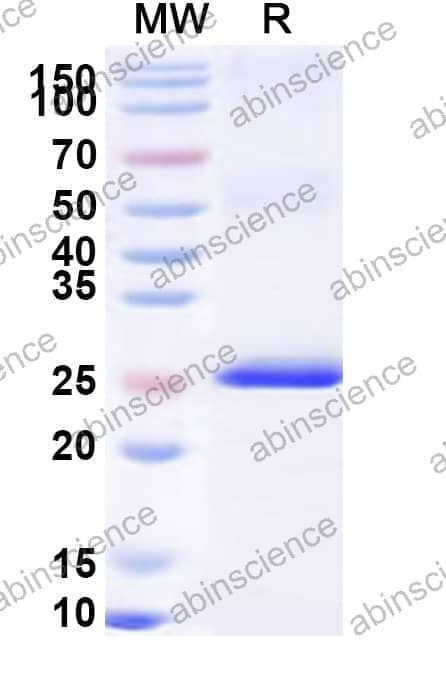 Human XPO4 Recombinant Protein (N-His)