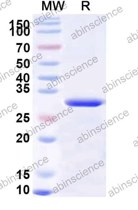 Human NUAK2 Recombinant Protein (N-His)