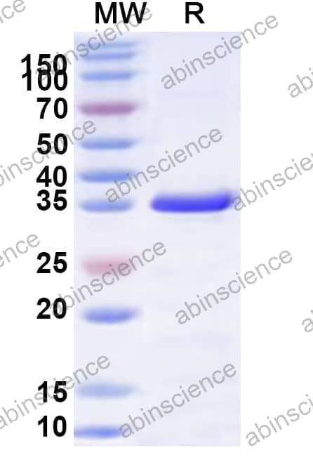 Human AP4M1 Recombinant Protein (N-His)