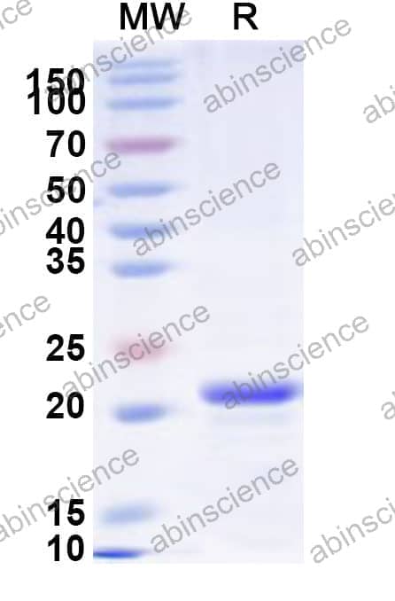 Human SCAMP1 Recombinant Protein (N-His)