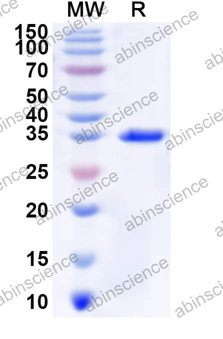 Human SLC6A11 Recombinant Protein (N-GST & C-His)