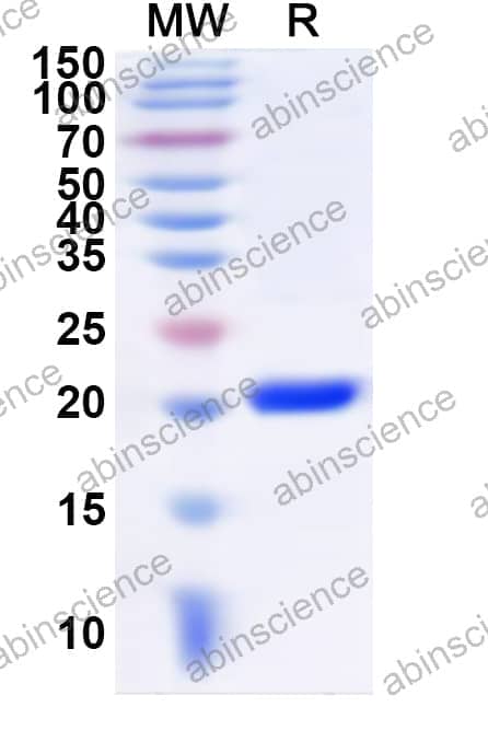 Human POU6F1 Recombinant Protein (N-His)