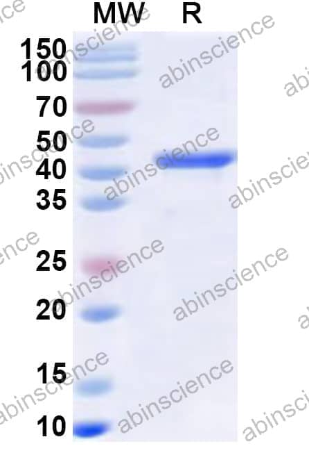 Human RNF126 Recombinant Protein (N-His)