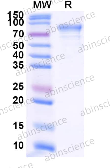 Human B4GALT1 Recombinant Protein (C-Fc)