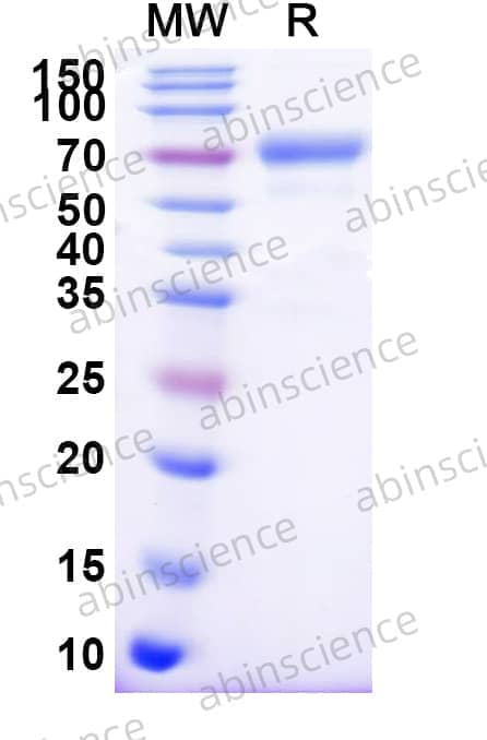 Human CD158b1/KIR2DL2 Recombinant Protein (C-Fc)