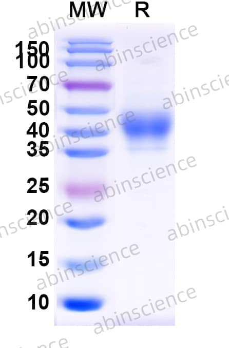Human CD158b1/KIR2DL2 Recombinant Protein (C-His)