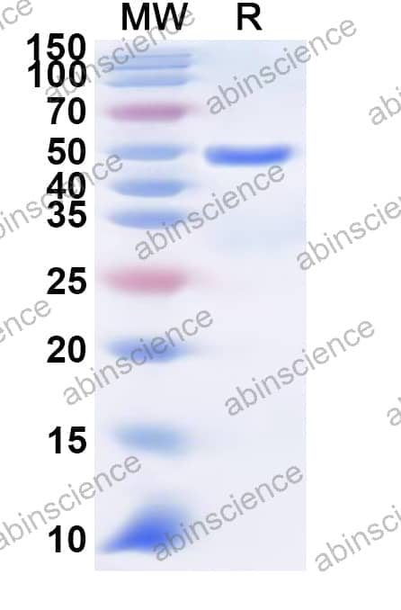 Human SLC36A1 Recombinant Protein (N-GST & C-His)