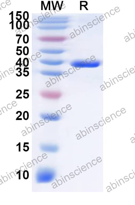 Human SLC7A10 Recombinant Protein (N-GST & C-His)