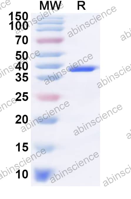 Human RABAC1 Recombinant Protein (N-GST & C-His)