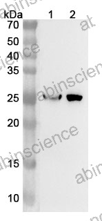 Anti-RABAC1 Polyclonal Antibody