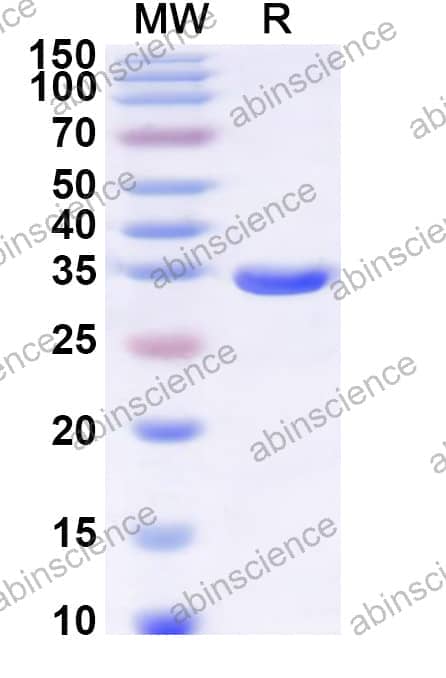 Human ELOVL6 Recombinant Protein (N-GST & C-His)