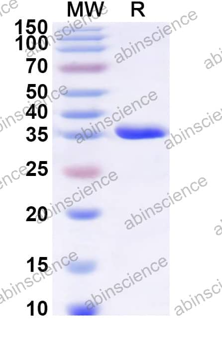 Human IFITM1 Recombinant Protein (N-GST & C-His)