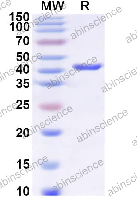 Human TIMM22 Recombinant Protein (N-GST & C-His)