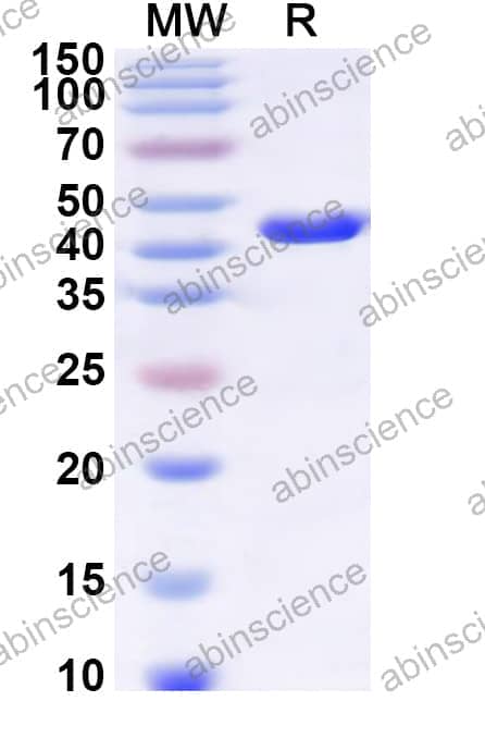 Human SLC25A1 Recombinant Protein (N-GST & C-His)