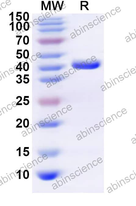 Human MTFP1 Recombinant Protein (N-GST & C-His)