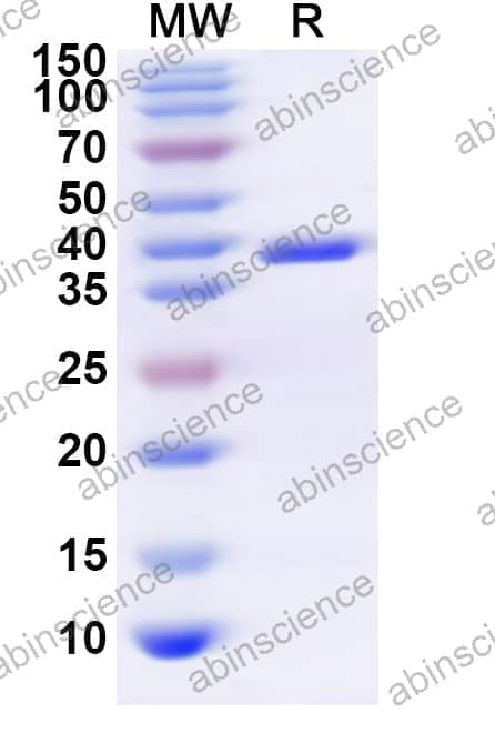 Human ADORA1 Recombinant Protein (N-GST & C-His)