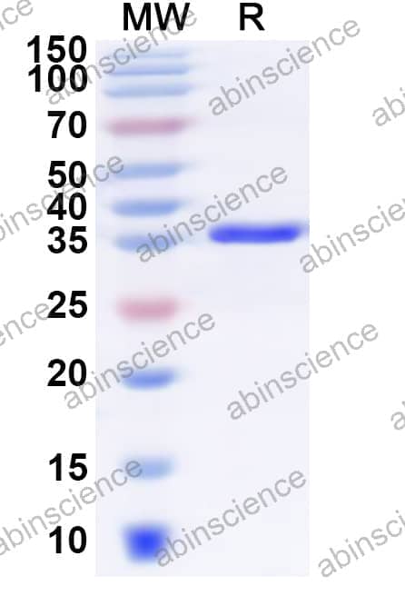 Human TIMM17B Recombinant Protein (N-GST & C-His)