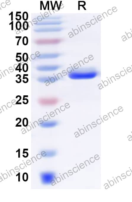 Human SLC7A5 Recombinant Protein (N-GST & C-His)