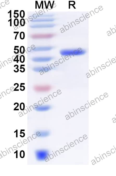 Human SLC10A2 Recombinant Protein (N-GST & C-His)