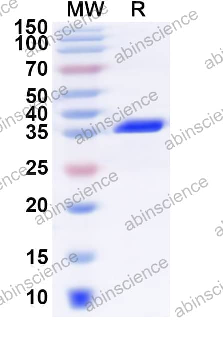 Human NDUFC2 Recombinant Protein (N-GST & C-His)