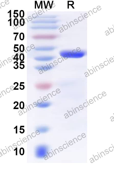 Human SLC31A1 Recombinant Protein (N-GST & C-His)