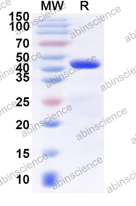 Human SLC25A17 Recombinant Protein (N-GST & C-His)