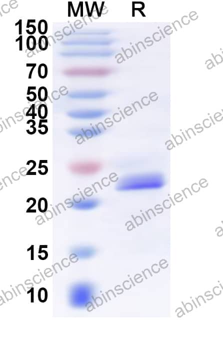 Human GPR39 Recombinant Protein (N-His)