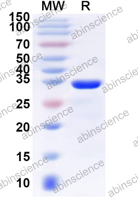 Human SLC31A2 Recombinant Protein (N-GST & C-His)
