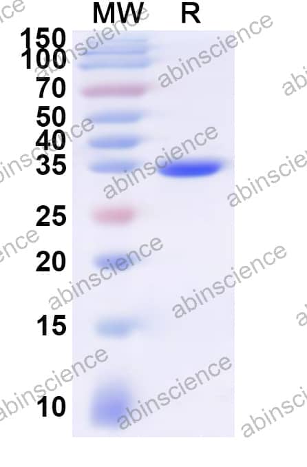 Human AQP8 Recombinant Protein (N-GST & C-His)