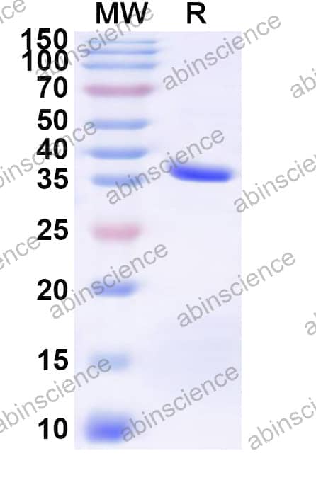 Human BEST1 Recombinant Protein (N-GST & C-His)