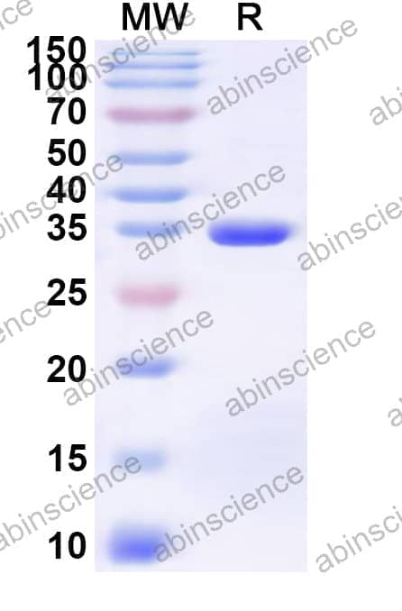 Human SLC19A2 Recombinant Protein (N-His-KSI)