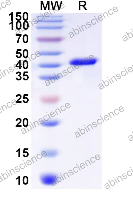 Human GJB6 Recombinant Protein (N-GST & C-His)