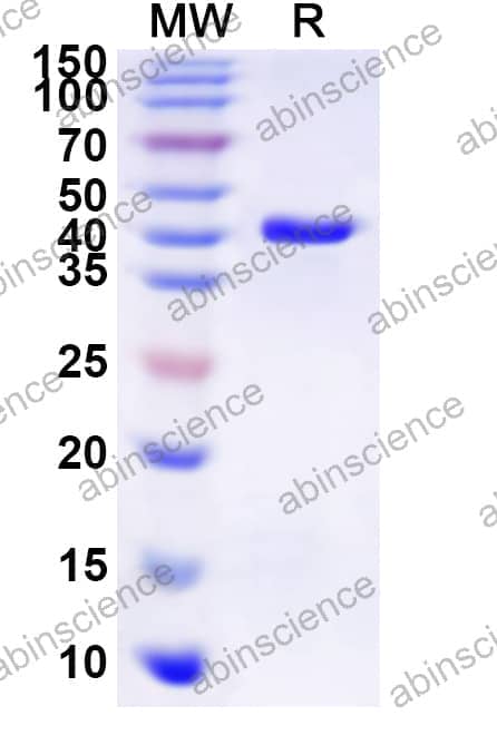 Human GJB5 Recombinant Protein (N-GST & C-His)