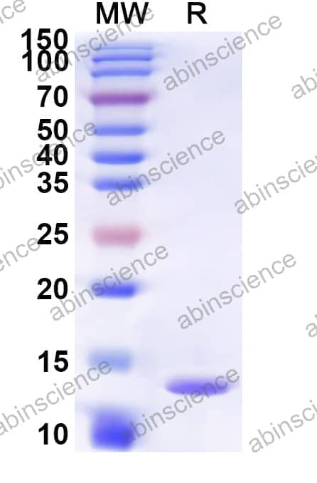 Human CCKAR Recombinant Protein (N-His-KSI)