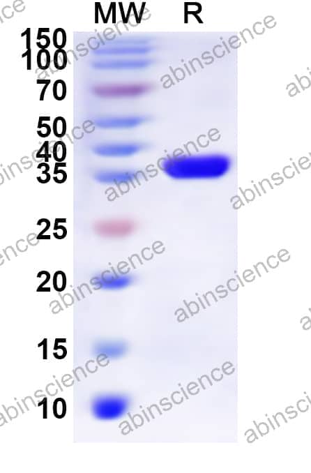 Human P2RY2 Recombinant Protein (N-His-KSI)