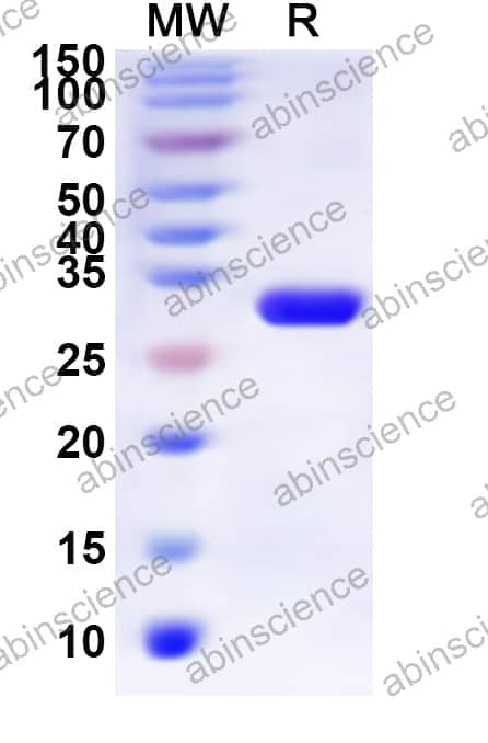 Human CHRM5 Recombinant Protein (N-His-KSI)