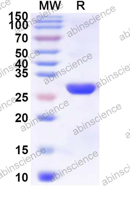 Human SLC2A2 Recombinant Protein (N-His-KSI)