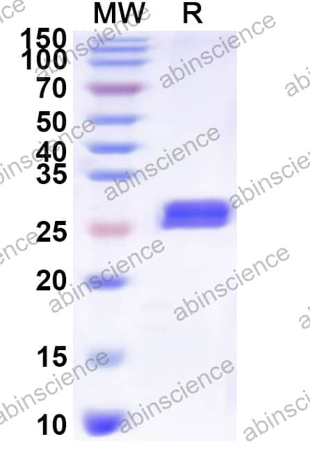 Human SLC7A1 Recombinant Protein (N-His-KSI)