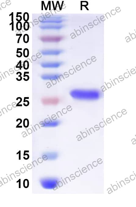 Human MC3R Recombinant Protein (N-His-KSI)